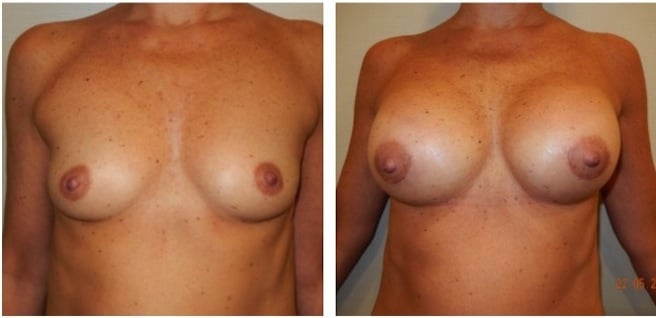 Diapositiva08