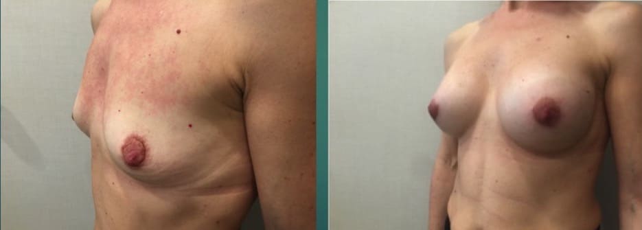 Diapositiva1