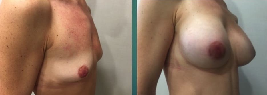 Diapositiva3