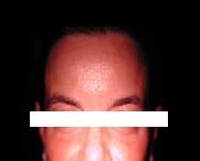 Peelings 9